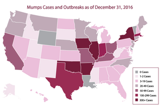 Illustration for article titled A Freak Mumps Outbreak Strikes Washington State